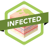 Infected