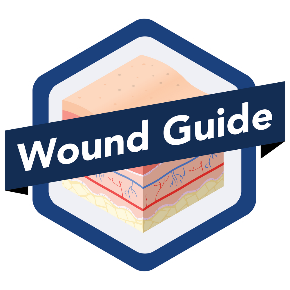 Wound Guide - Necrotic – Advancis Medical