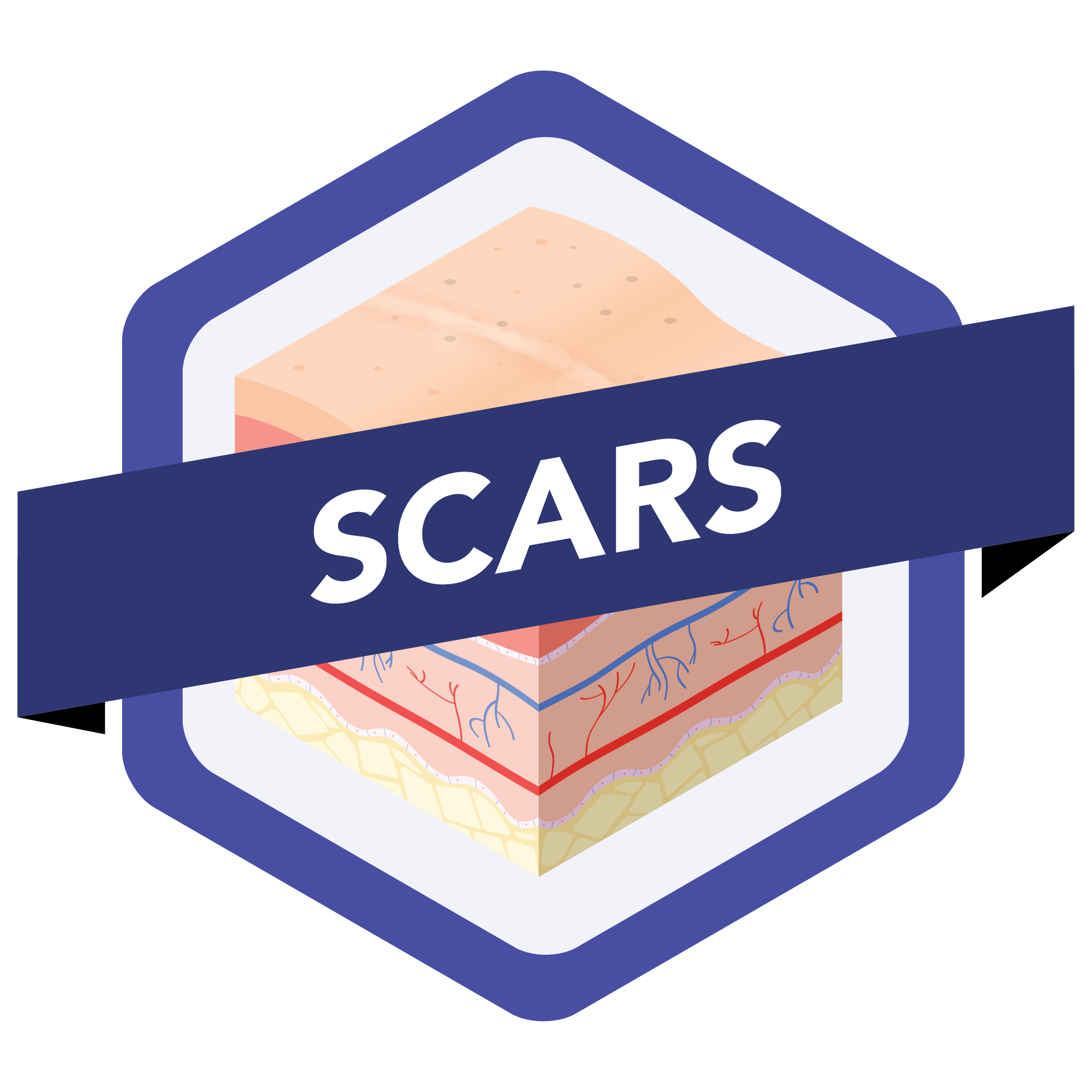 Scars